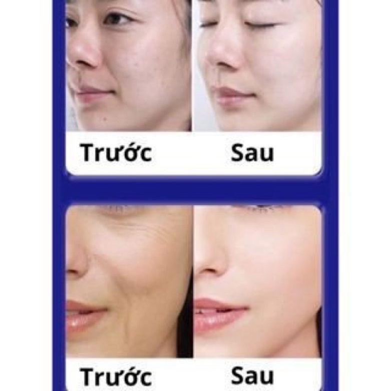 Kem UCM xóa nhăn, mờ nám trẻ hóa làn da nội địa nhật