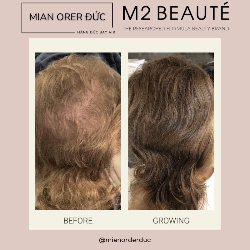 Serum mọc tóc M2 BEAUTÉ hair activating serum 120ml - hàng nội địa Đức
