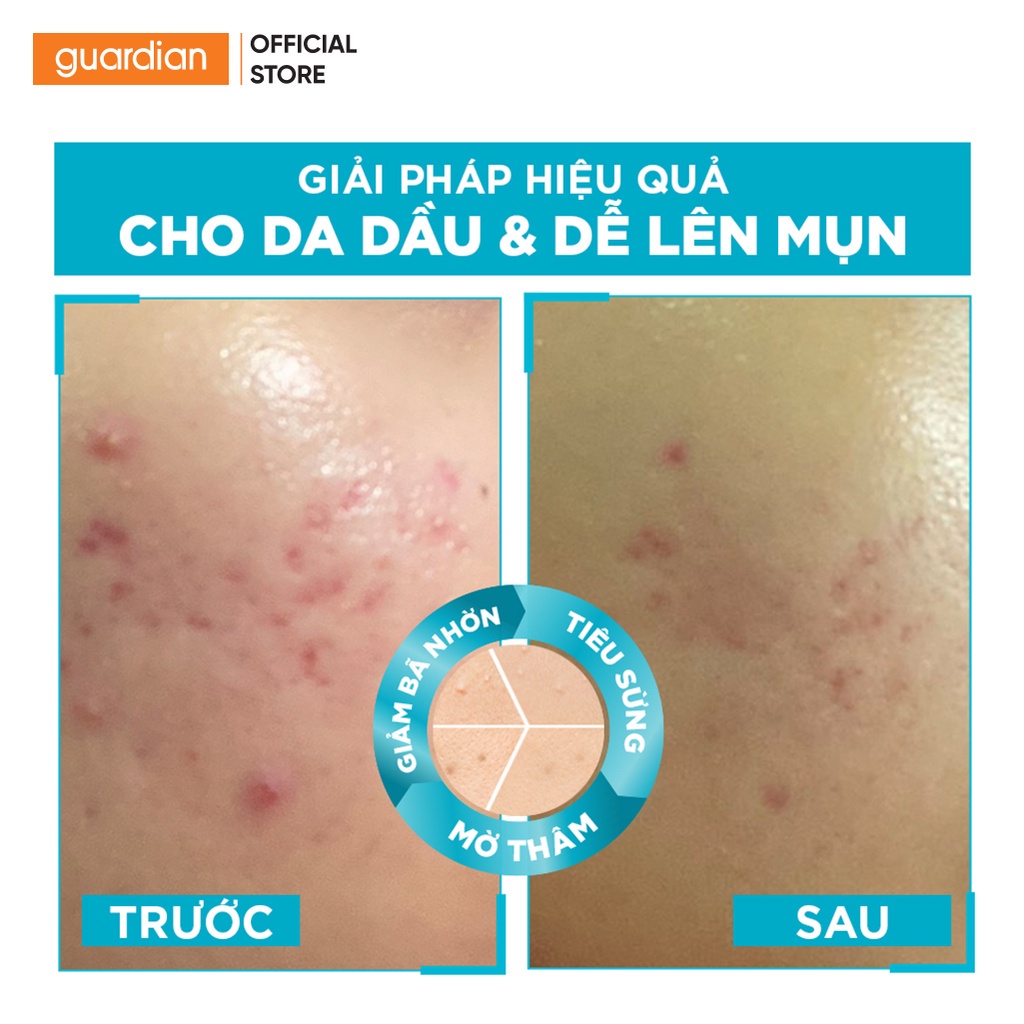 Tinh Chất Mờ Thâm Sáng Da Garnier Bright Complete Anti-Acness Booster Serum 4% Cho Da Dầu Mụn 30ml