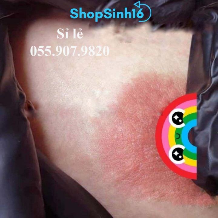 Set Peel Khử Thâm Kèm Kem Dưỡng Hồng Nhũ Hoa Vùng Kín Lypink X10 Thấm Nhanh, Hồng Hào ShopSinh16