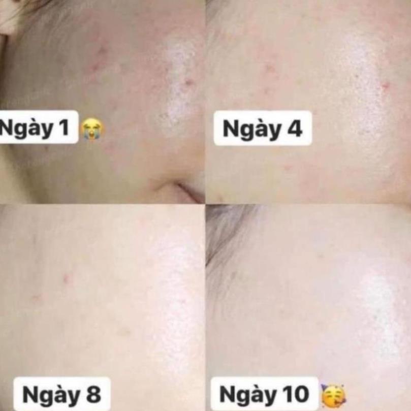 Kem Dưỡng Trắng Da Glutathione Melasma-x BEAUTÉ