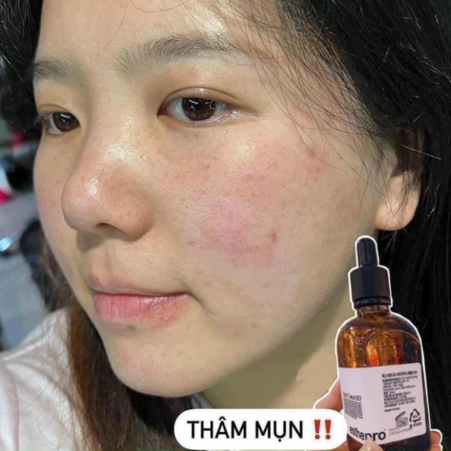 Serum Vitamin C Serum 561 Esthemax, Giúp trắng sáng da, chống lão hóa lọ 100ml
