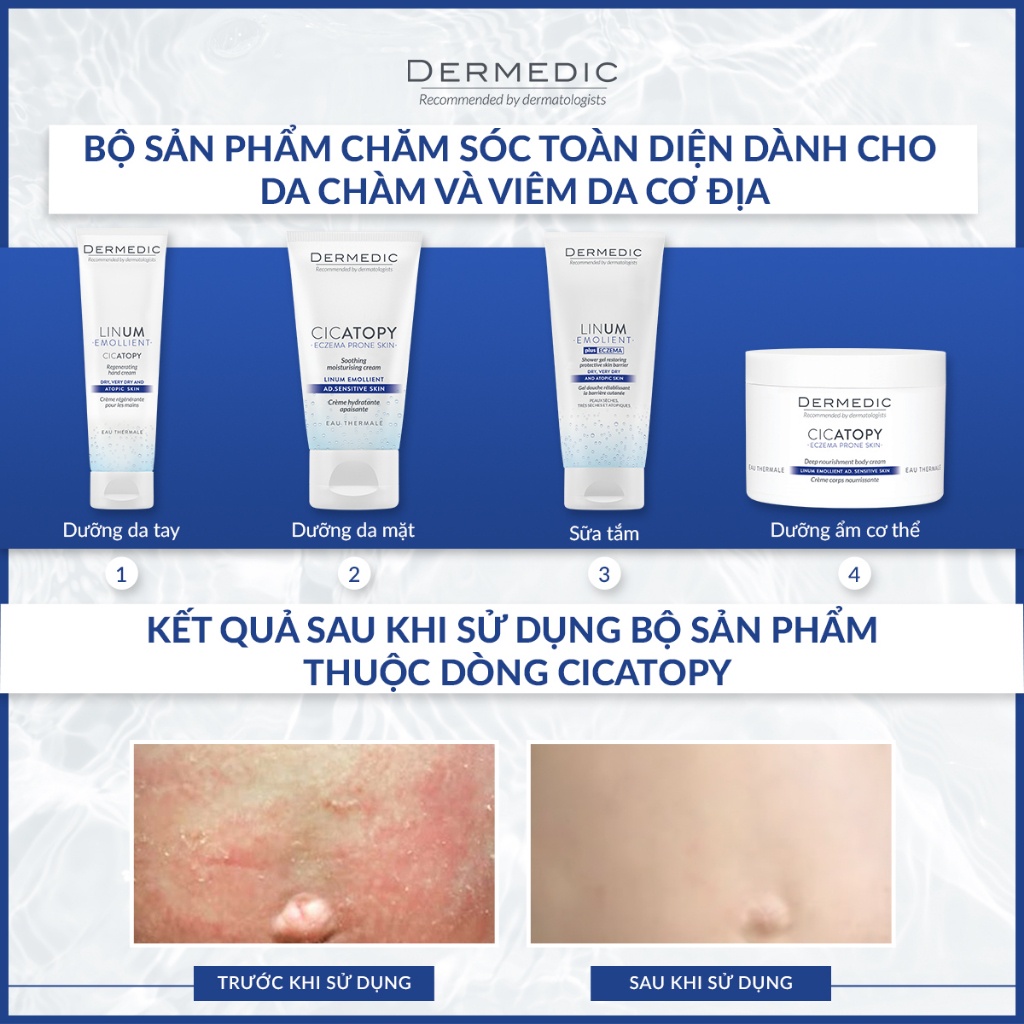 Sữa tắm phục hồi da Dermedic CICATOPY SHOWER GEL RESTORING PROTECTIVE SKIN BARRIER 200ml