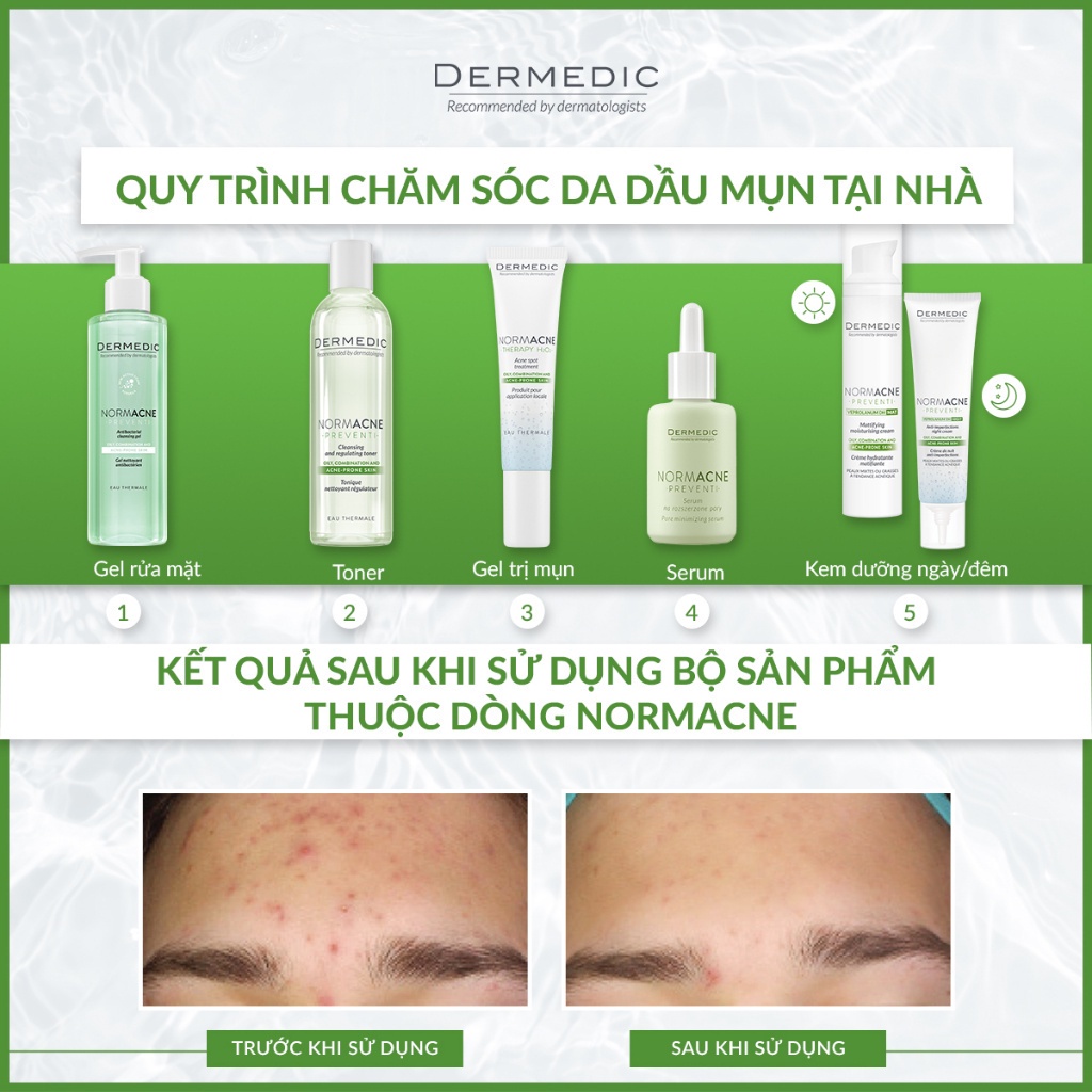 Sữa rửa mặt dạng gel làm sạch dành cho da dầu da mụn Dermedic Normacne Antibacterial Cleansing Gel