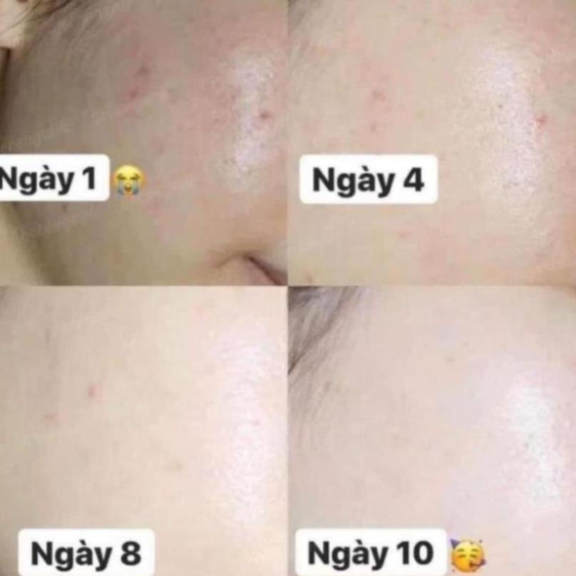 Kem Dưỡng Trắng Da Glutathione Melasma-x BEAUTÉ