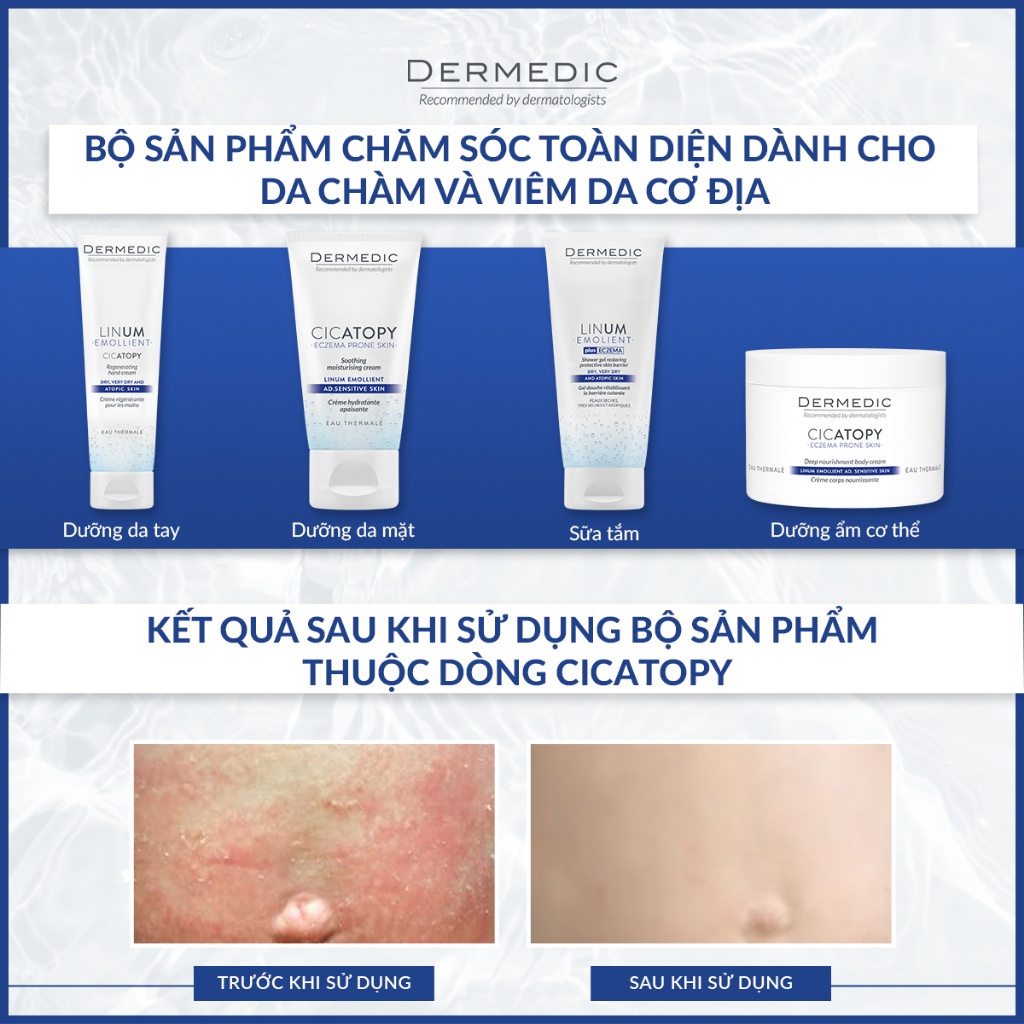 Kem dưỡng ẩm body Dermedic Cicatopy Deep Nourishment Body Cream 225ml