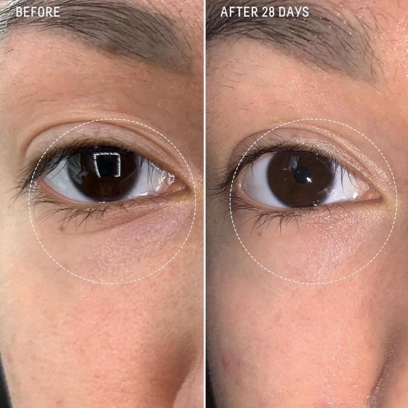 Serum dưỡng mắt chống lão hóa Dr Dennis Gross Ferulic Retinol Eye Cream