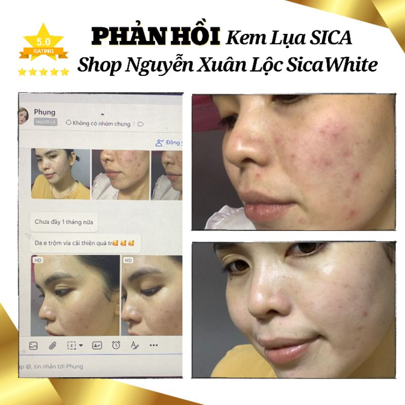 Kem Dưỡng TRẮNG - Mờ THÂM NÁM - Phục hồi da - MINI 6g  và FULL 25g - Chính Hãng Sica White