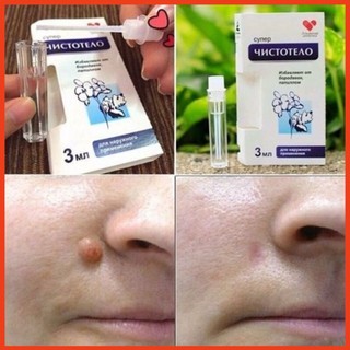 Gel tẩy nốt ruồi DVELINIL Nga tẩy nốt ruồi, mụn cơm, mụn cóc, mụn thịt