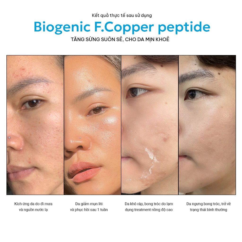 Serum Phục Hồi Đa Tác Động - Biogenic F. Copper Peptide - Giảm kích ứng, Ngừa sẹo sau mụn Twins Skin 30ml và 10ml