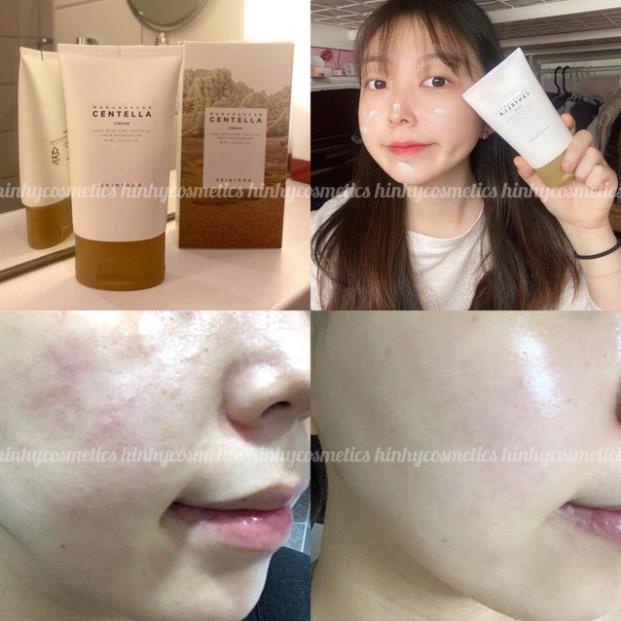 Kem dưỡng rau má SKIN1004 Madagascar Centella Cream - Soothing Cream 75 ml