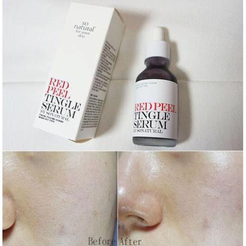 Thay Da Sinh Học Red Peel Serum 11ML