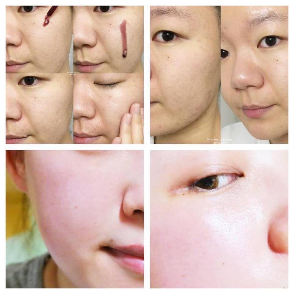 Thay Da Sinh Học Red Peel Serum 11ML