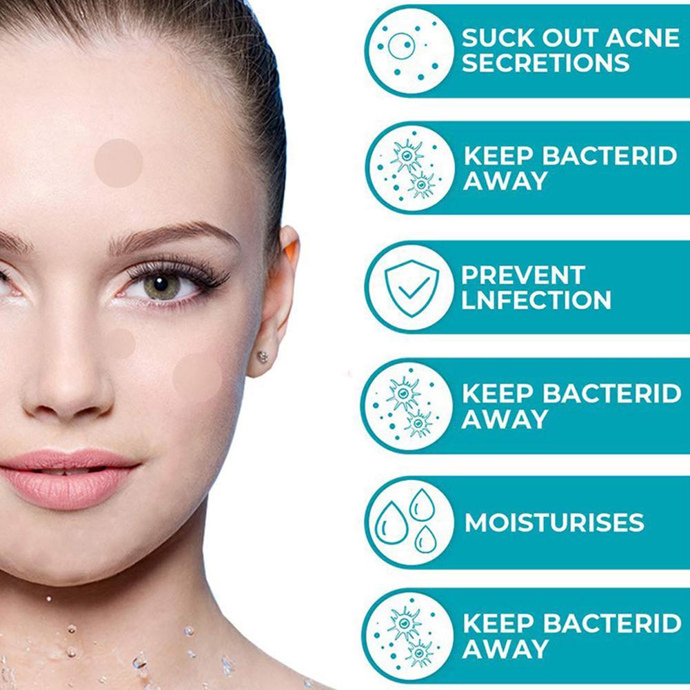 SOUG Miếng Dán Hỗ trợ giảm mụn Dạng Gel Nước Vô Hình OEM