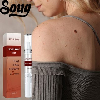 SOUG Dung Dịch Loại Bỏ Mụn Thịt Dư Trên Da Không Đau Dung Tích 3ml