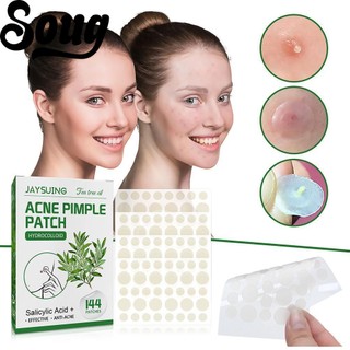 SOUG Miếng Dán Hỗ trợ giảm mụn Tinh Dầu Tràm Trà Làm Mờ S2H4