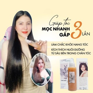 Xịt Dưỡng Tóc Tuệ Vi 100ml, kích thích mọc tóc nhanh