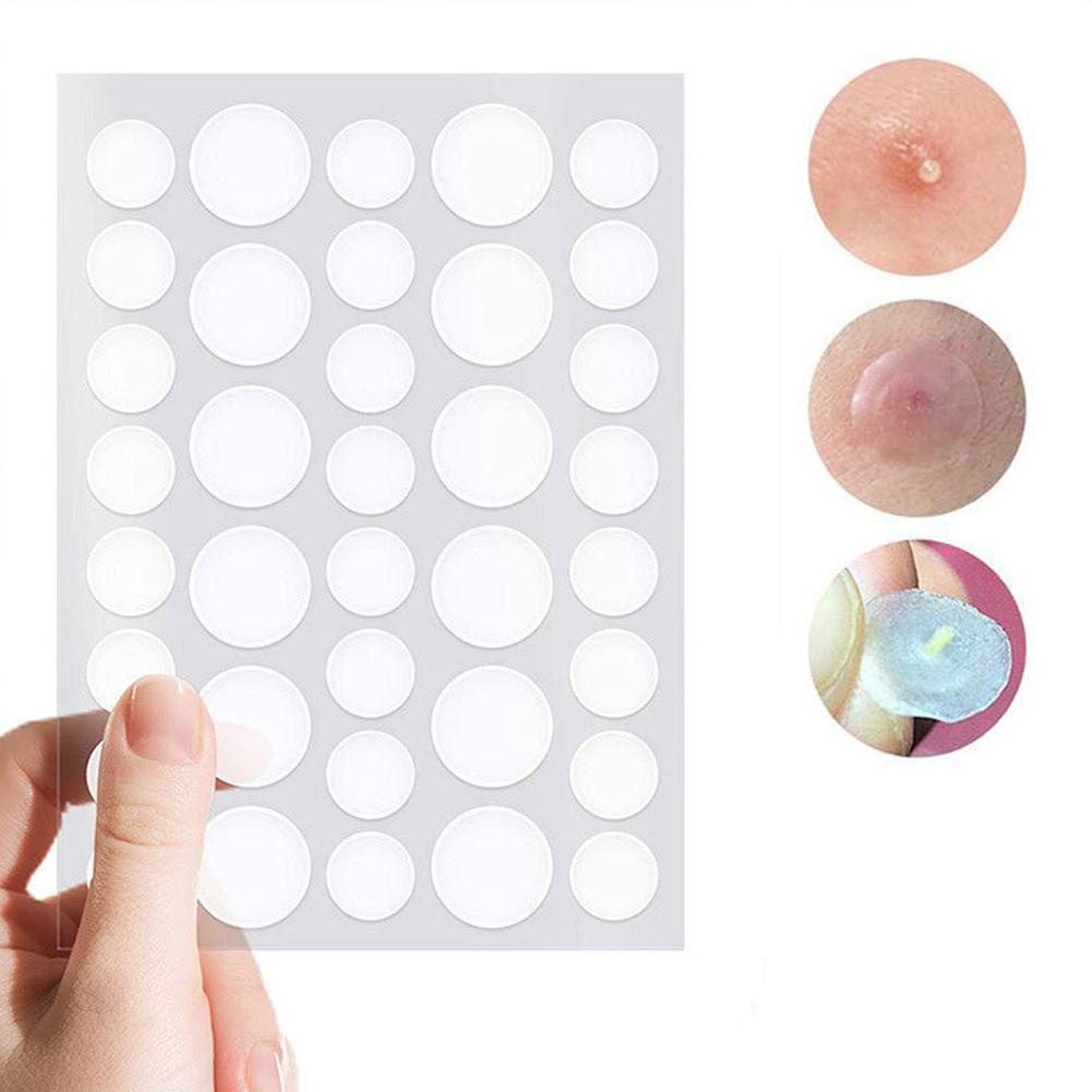SOUG Miếng Dán Hỗ trợ giảm mụn Dạng Gel Nước Vô Hình OEM
