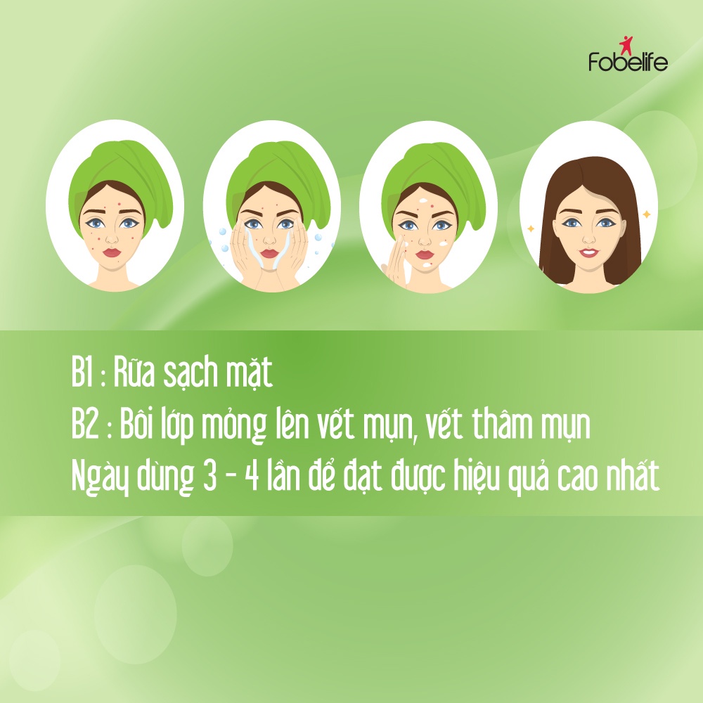 Kem Làm Giảm Thâm Mụn Sẹo Mụn Fobe Acne Chai 15g
