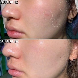 KEM DƯỠNG KIỀM DẦU BIODERMA MAT CONTROL