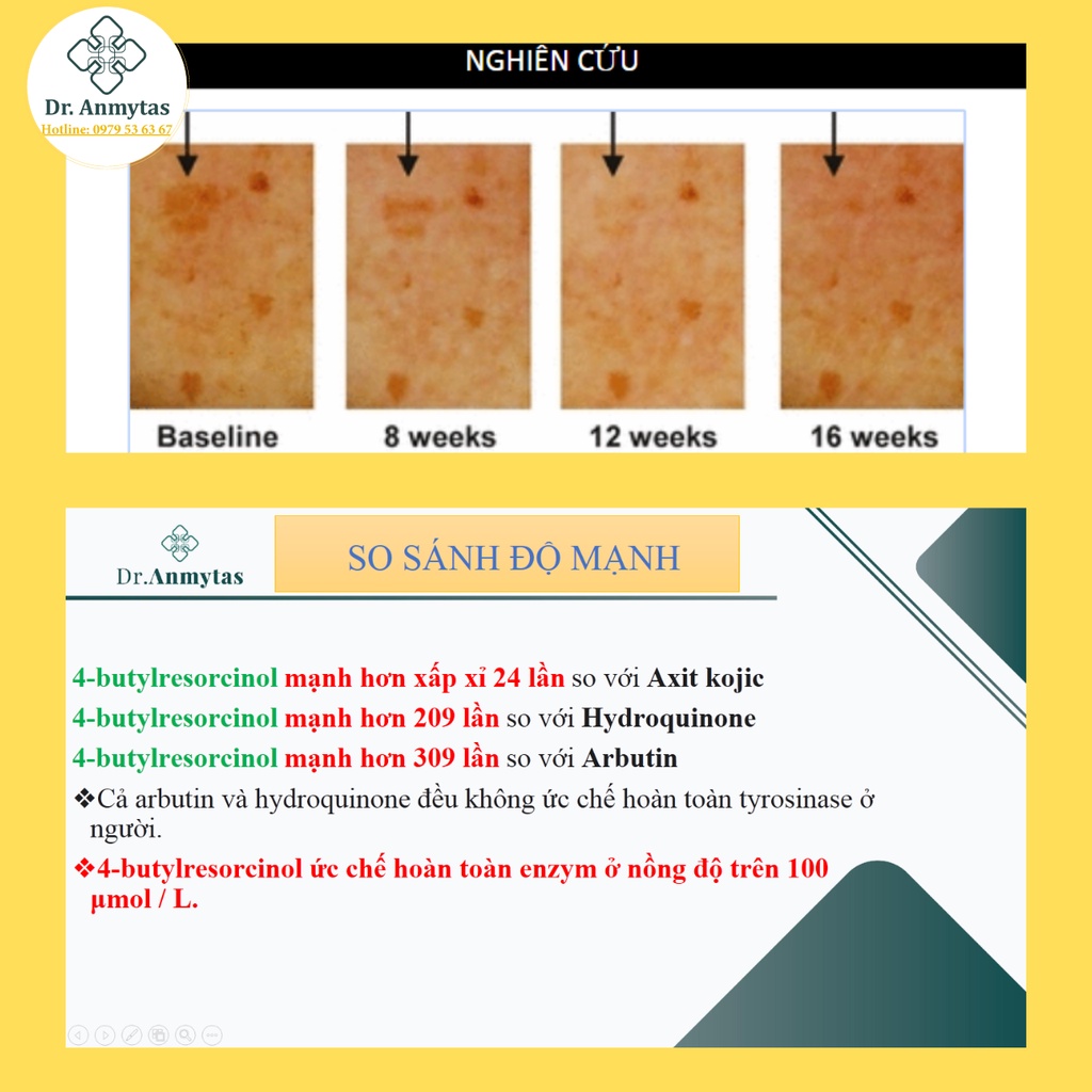 Kem Mờ Nám 4-Butylresorcinol Dr. Anmytas - Làm Sáng Da, Xóa Mờ Thâm Nám