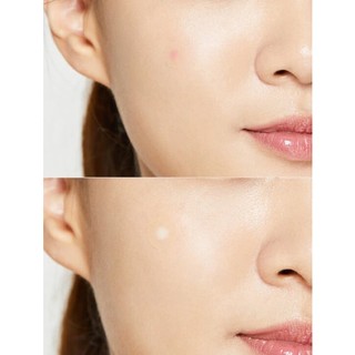 Miếng dán mụn trứng cá Cosrx Acne Pimple Master Patch