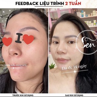 Kem Dưỡng Ẩm Trắng Da