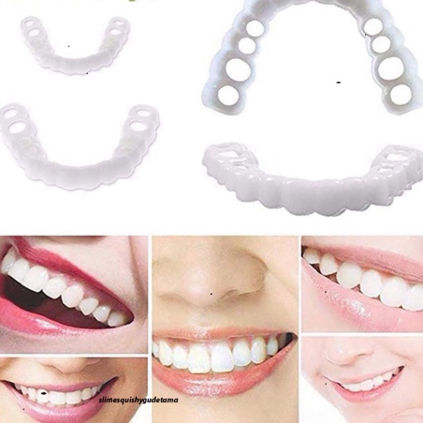 [có sẵn] Hàm răng làm giả trên + dưới bằng silicone làm răng trắng sáng đồng đều cho thú vui xinh xẻ