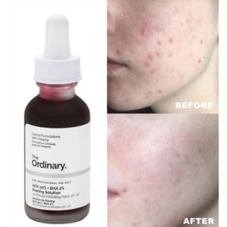 Tinh Chất Peel da The Ordinary AHA 30%+BHA 2% Peeling Solution 30ml- CH