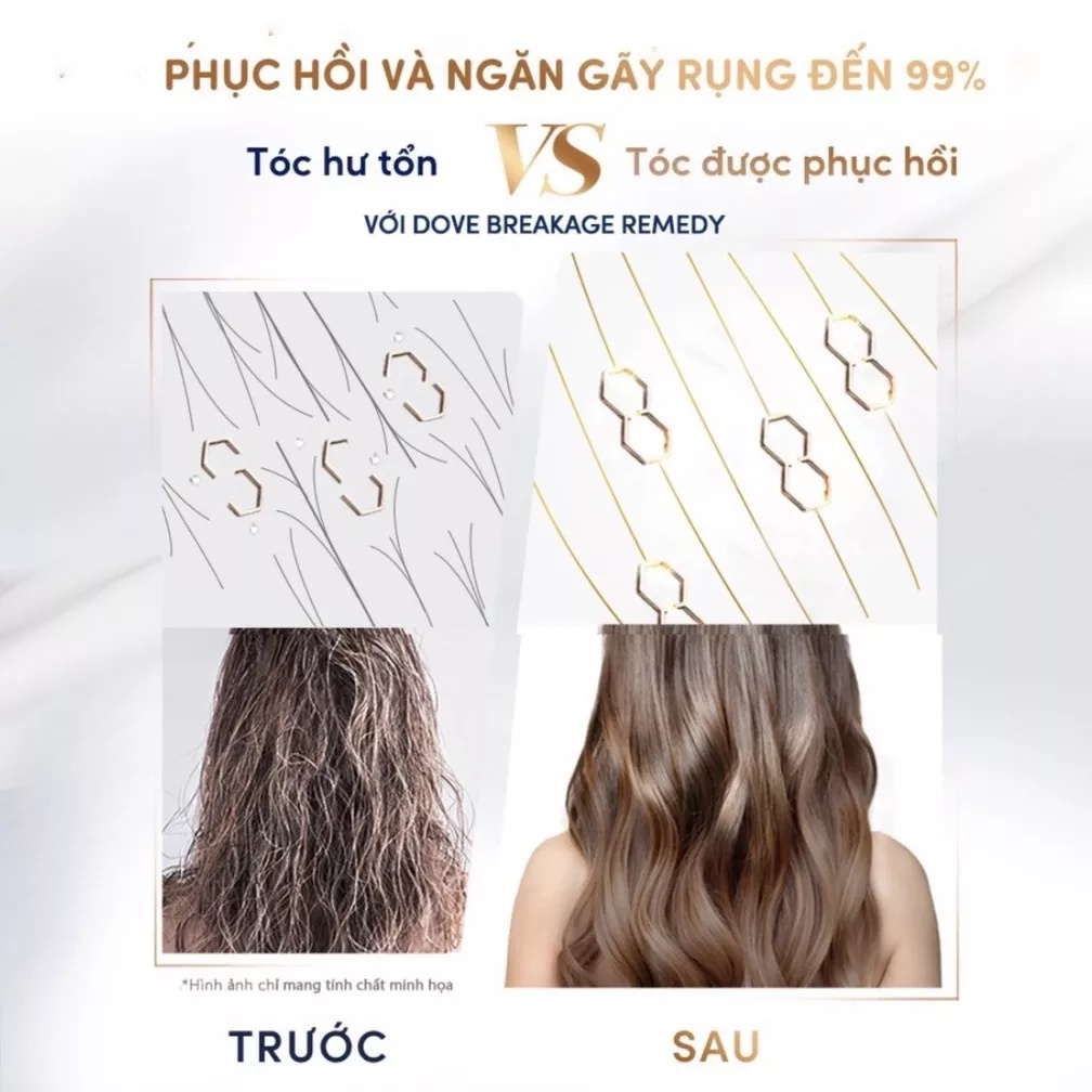 Kem Xả Serum 2 Trong 1 Dove Hair Therapy Breakage Remedy Giúp Phục Hồi & Giúp Giảm Gãy Rụng 230ml