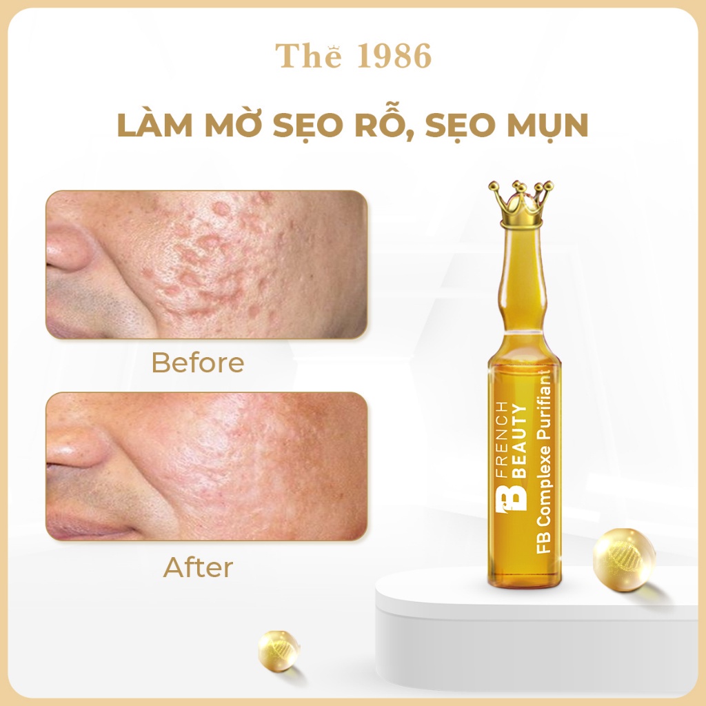 French Beauty - Tinh Chất Serum Tái Tạo, Phục Hồi Sẹo Rỗ, Sẹo Lõm FB Complexe Purifiant