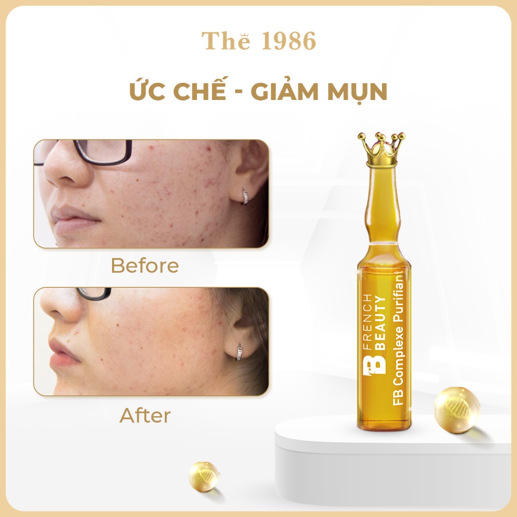 French Beauty - Tinh Chất Serum Tái Tạo, Phục Hồi Sẹo Rỗ, Sẹo Lõm FB Complexe Purifiant