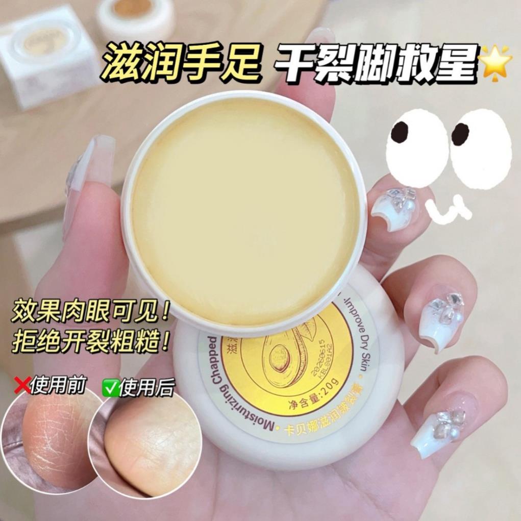 Kem Ngăn Ngừa Chống Nứt Nẻ Gót Chân Heyxi, Kem Phục Hồi Da Chân, Da Tay Nứt Nẻ Hiệu Quả Sau 7 Ngày Sử Dụng
