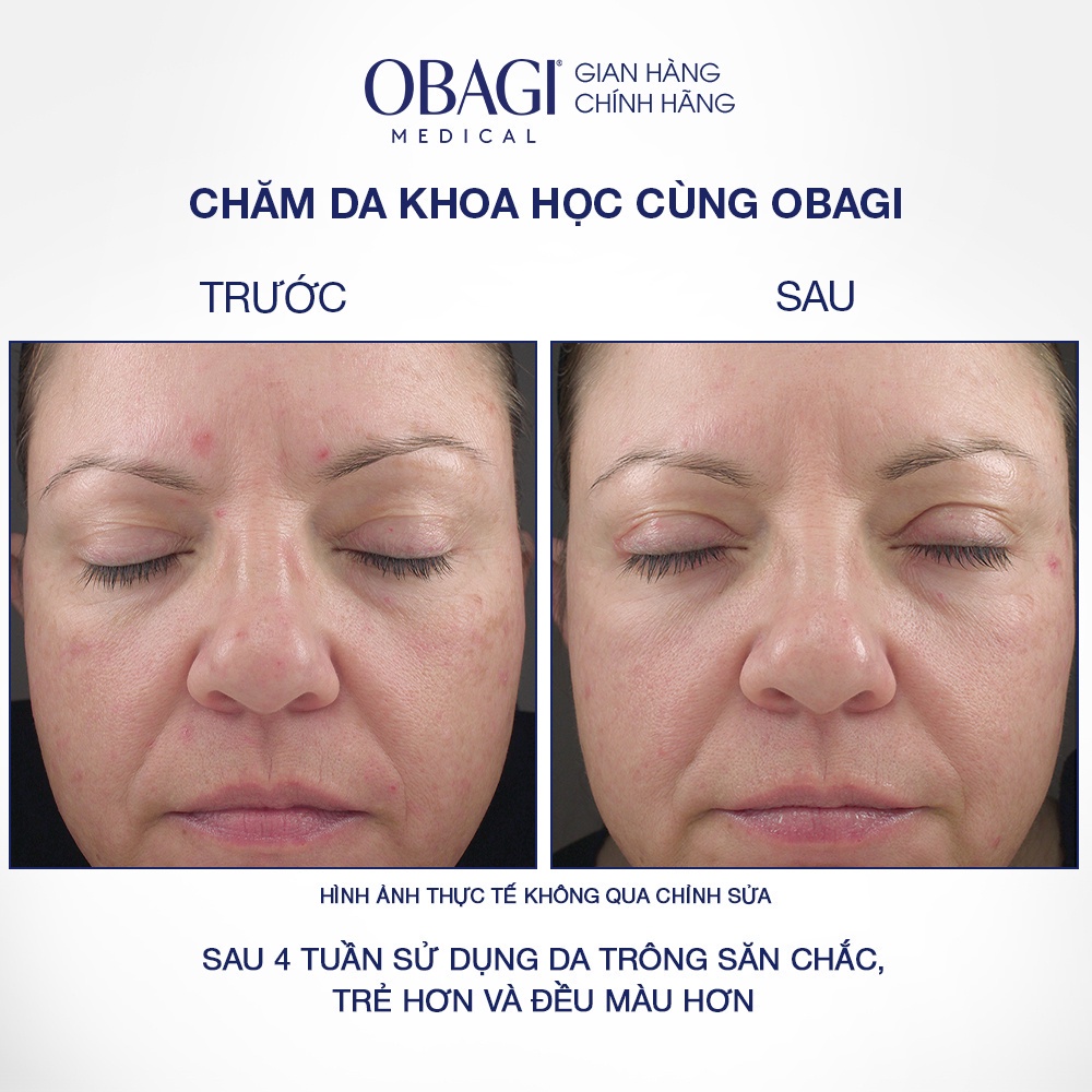 Kem Chống Lão Hóa & Tái Tạo Da Obagi 360 Retinol 0.5 28g