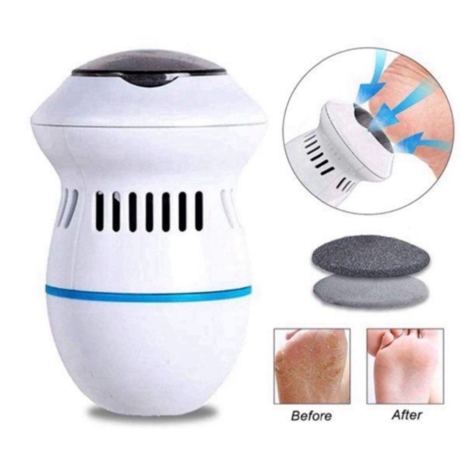 Máy mài gót chân tẩy tế bào chết có cổng USB - Máy Chà Gót Chân