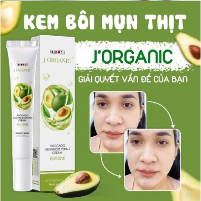 Kem bôi mụn thịt Jorganic, J'organic , kirozi nhật bản