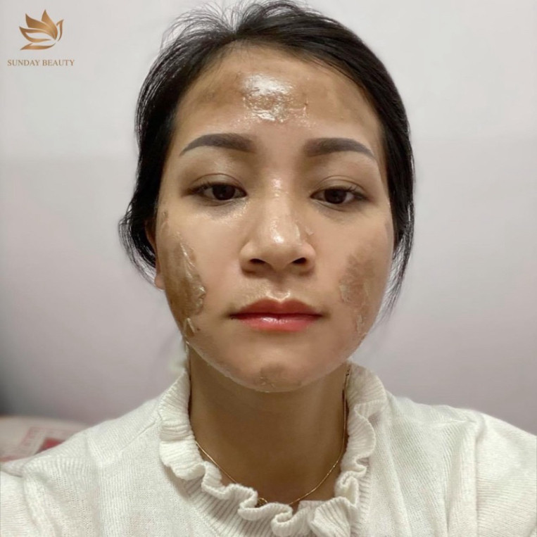 Peel da Peel da ROYCE SKIN M+ Peel da sinh học chuẩn minh tinh ,