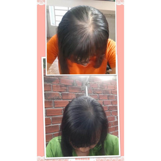 (Hữu cơ thảo dược) DẦU GỘI BỒ KẾT THẢO MỘC HERBYOU