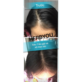 (Hữu cơ thảo dược) DẦU GỘI BỒ KẾT THẢO MỘC HERBYOU