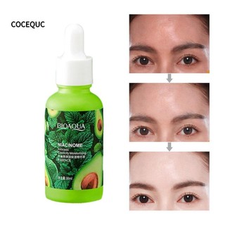 COCEQUC (Hàng Mới Về) Serum Chiết Xuất Bơ Dưỡng Ẩm Làm Sáng Da Se Khít Lỗ Chân Lông 30ml