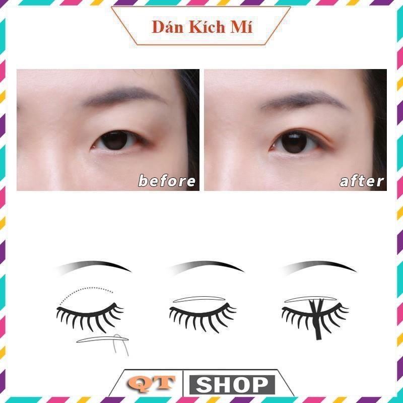 Miếng dán mí vân lưới hộp 600 cái