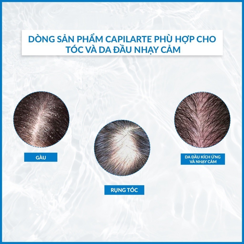 Dầu Gội Sạch Gàu Giảm Ngứa Da Đầu Dermedic Capilarte Anti Dandruff Shampoo Combating Its Cause 300Ml