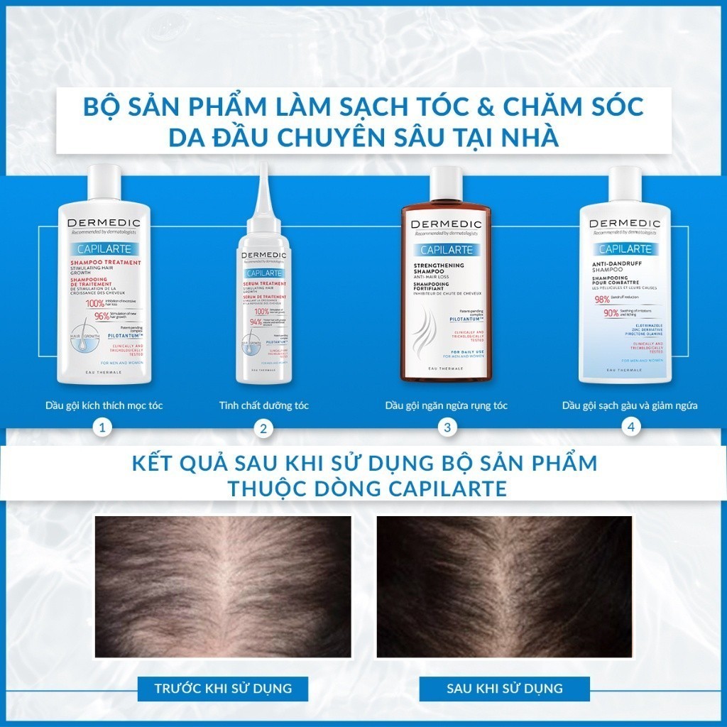 Dầu Gội Sạch Gàu Giảm Ngứa Da Đầu Dermedic Capilarte Anti Dandruff Shampoo Combating Its Cause 300Ml