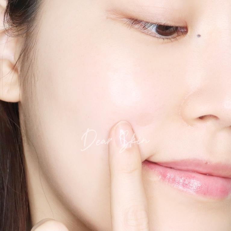 Miếng Dán Mụn COSRX Acne Pimple - Clear Fit Master Patch - COSRX đỏ