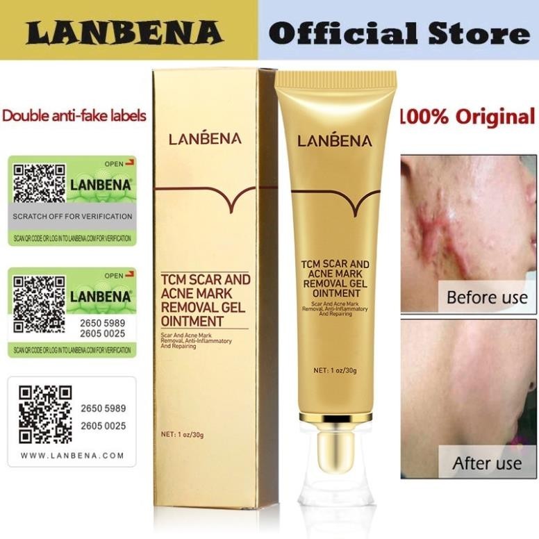 Kem Xóa Sẹo Rỗ LANBENA - Chuyên Sẹo Lâu Năm