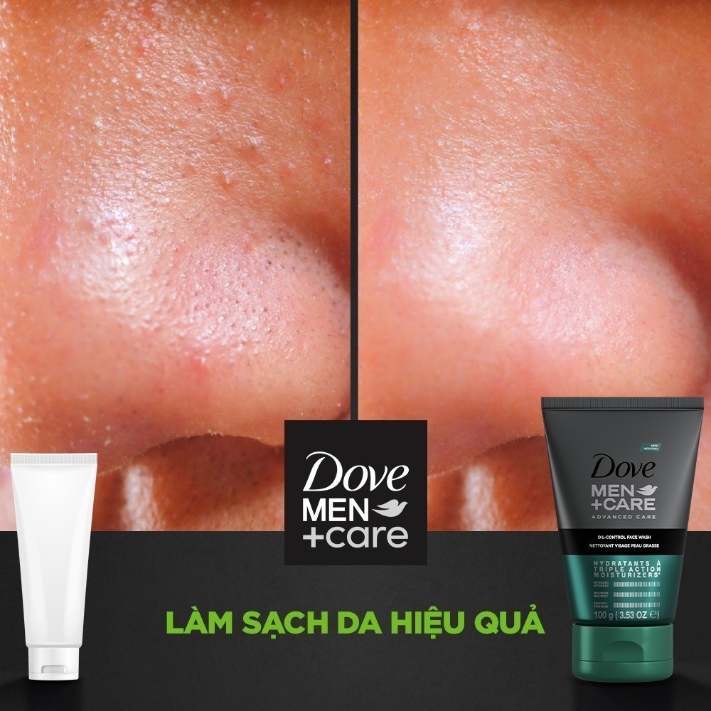Sữa rửa mặt Dove Men+Care kiềm dầu 100g