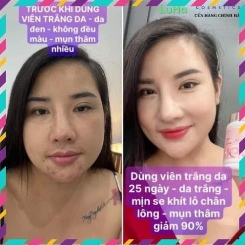 Giá gốc Viên ngậm Glutathione 2500 chính hãng, viên uống trắng da, mờ nám, hủy nám, cân bằng nội tiết tố nữ