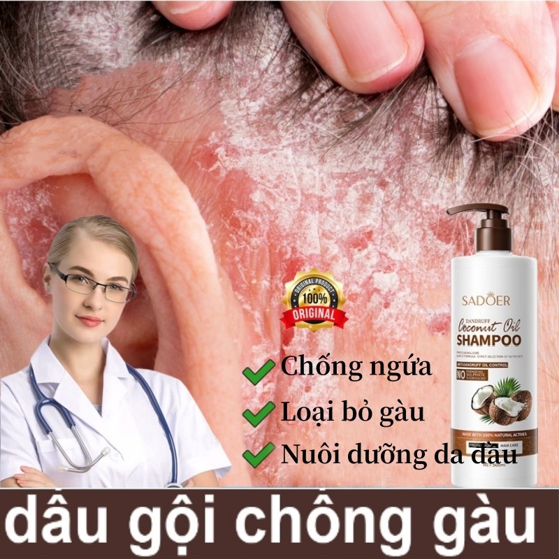 dầu gội dừa dầu 500ml dầu gội trị gàu dầu gội trị nấm da đầu cải thiện tóc hư tổn dầu gội giảm ngứa Sạch Gàu Và Giúp Tóc