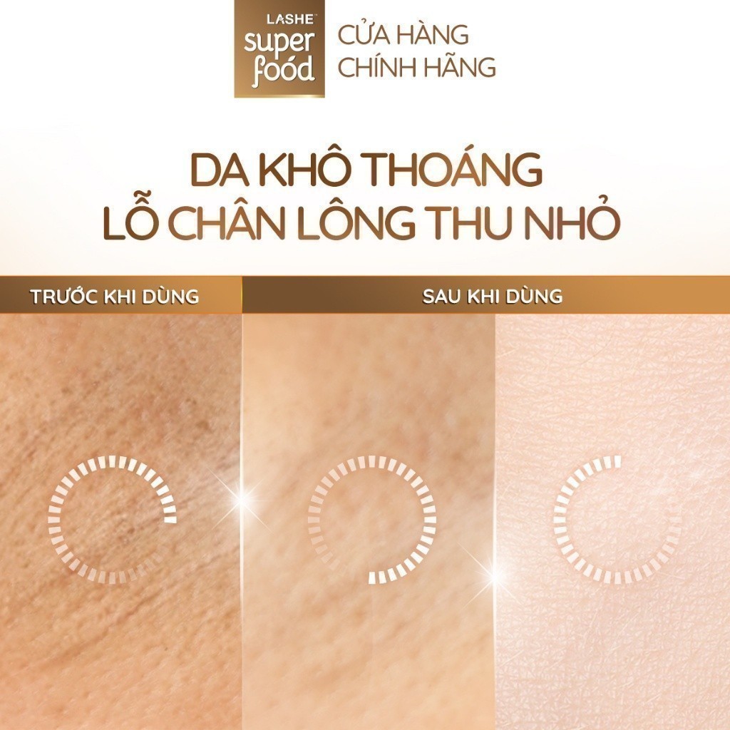 Combo 2 Lăn hút mùi LASHE SUPERFOOD se khít lỗ chân lông 50mlx2