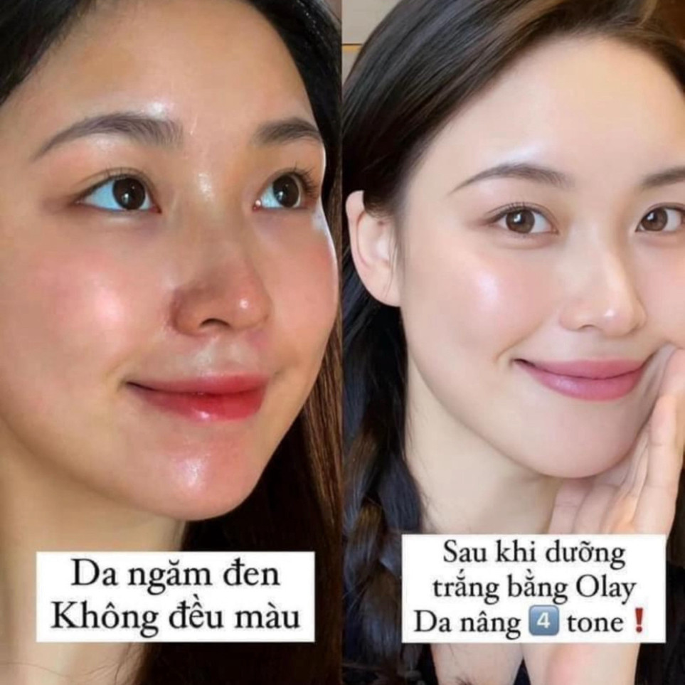 Kem olay 7in1, Olay total effects 7 in 1 , kem ngày và đêm ngừa  lão hóa của da,dưỡng da trắng sáng mịn | BigBuy360 - bigbuy360.vn